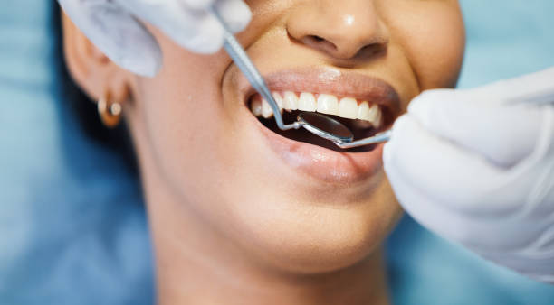 Best Emergency Tooth Extraction in Ennis, TX